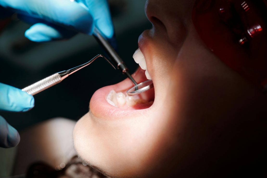 Caso de dentista suspeito de agredir criança foi arquivado. Foto: Celdric Fauntleroy/Pexels